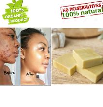 100% Organic Rice Soap brightening acne Dark spots collagen rice milk soap rice water Hair growth